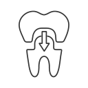 ceramic crowns folsom