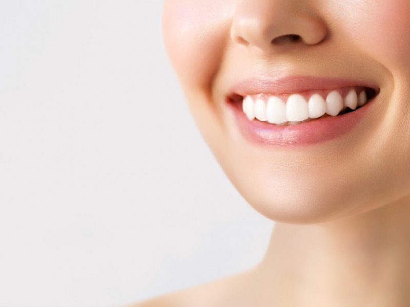 professional teeth whitening can work wonders for your smile