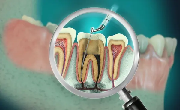 endodontics near you