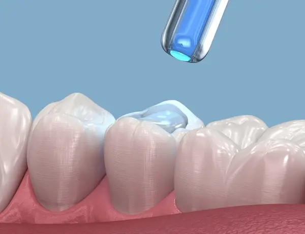 restorative dentistry in downtown toronto on