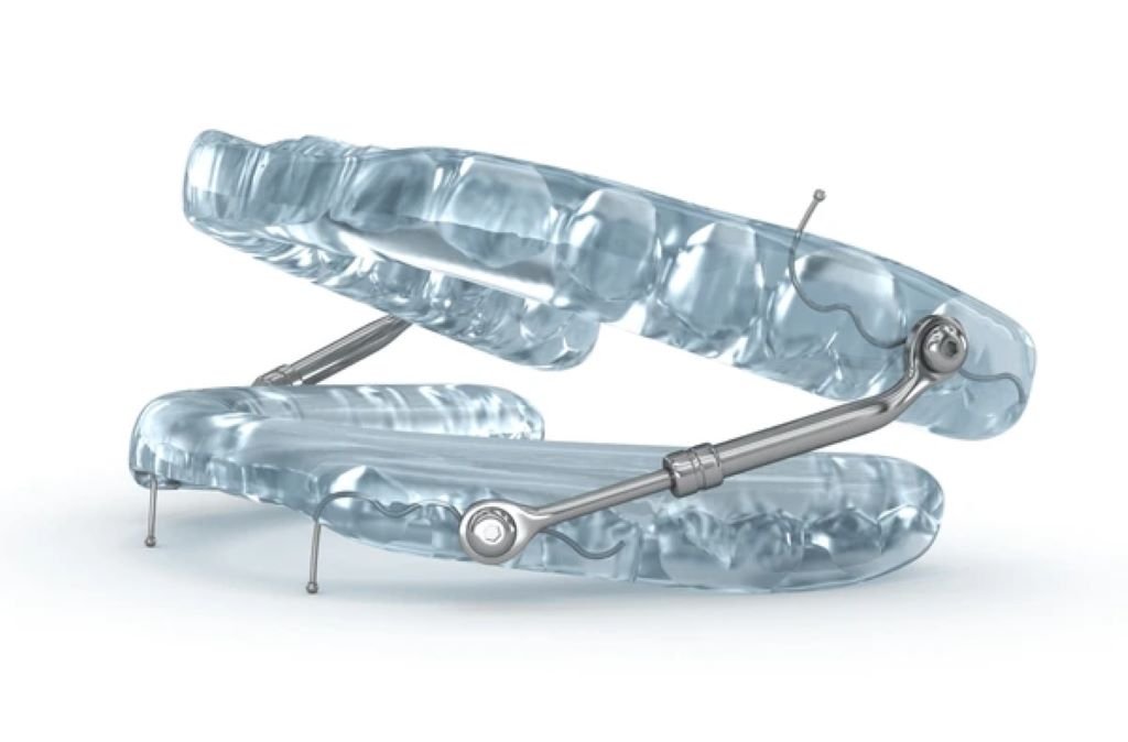oral appliance therapy in san diego