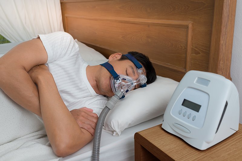 sleep apnea oral appliances