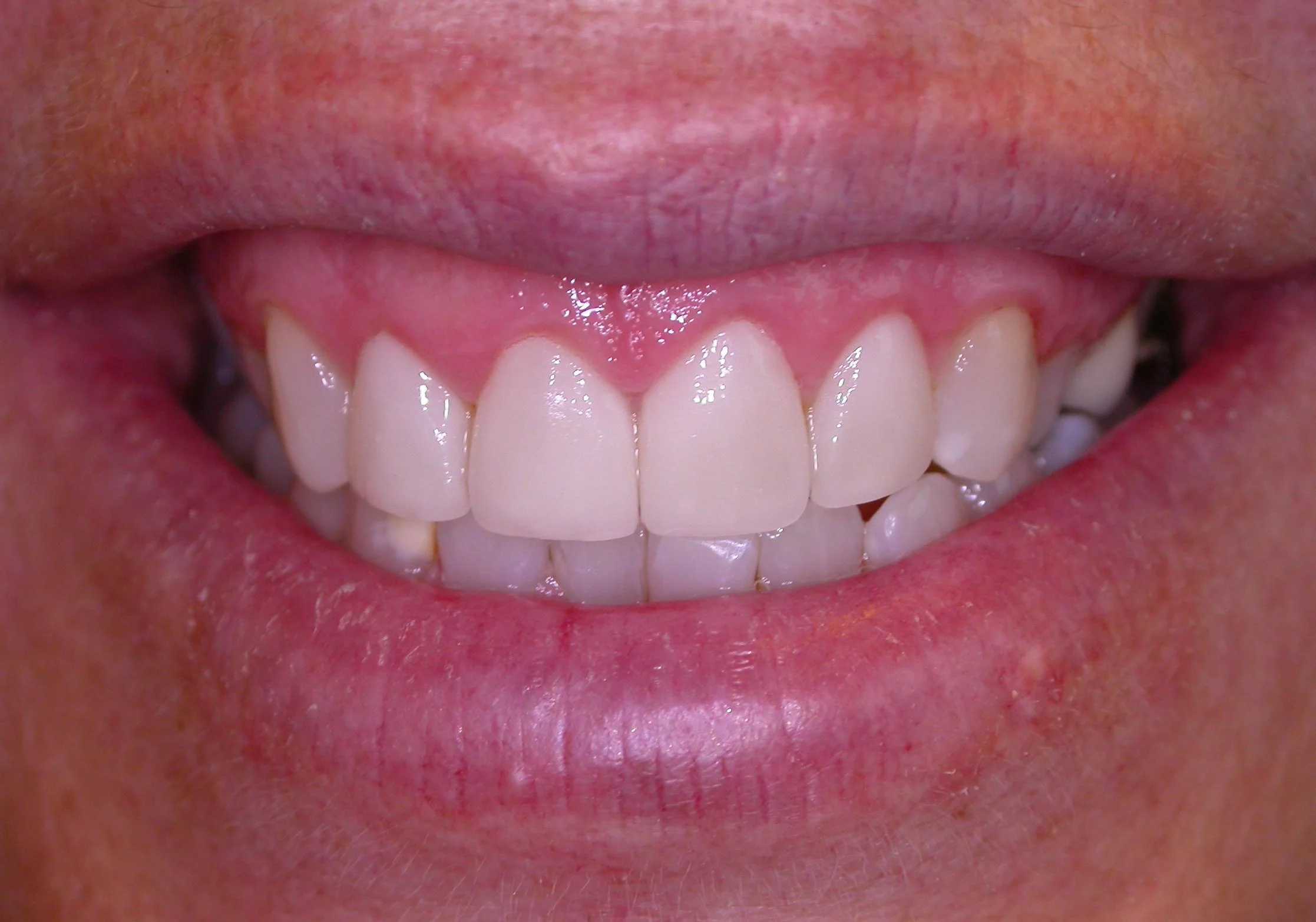 healthy oral appearance after clinical treatment