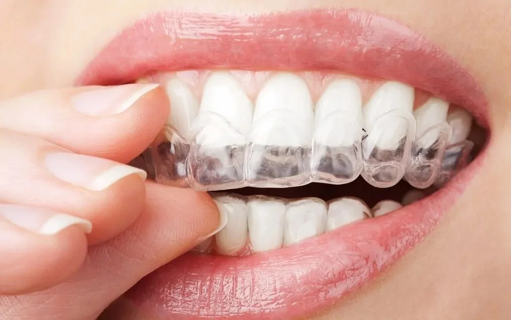 patient information team smile dentistry