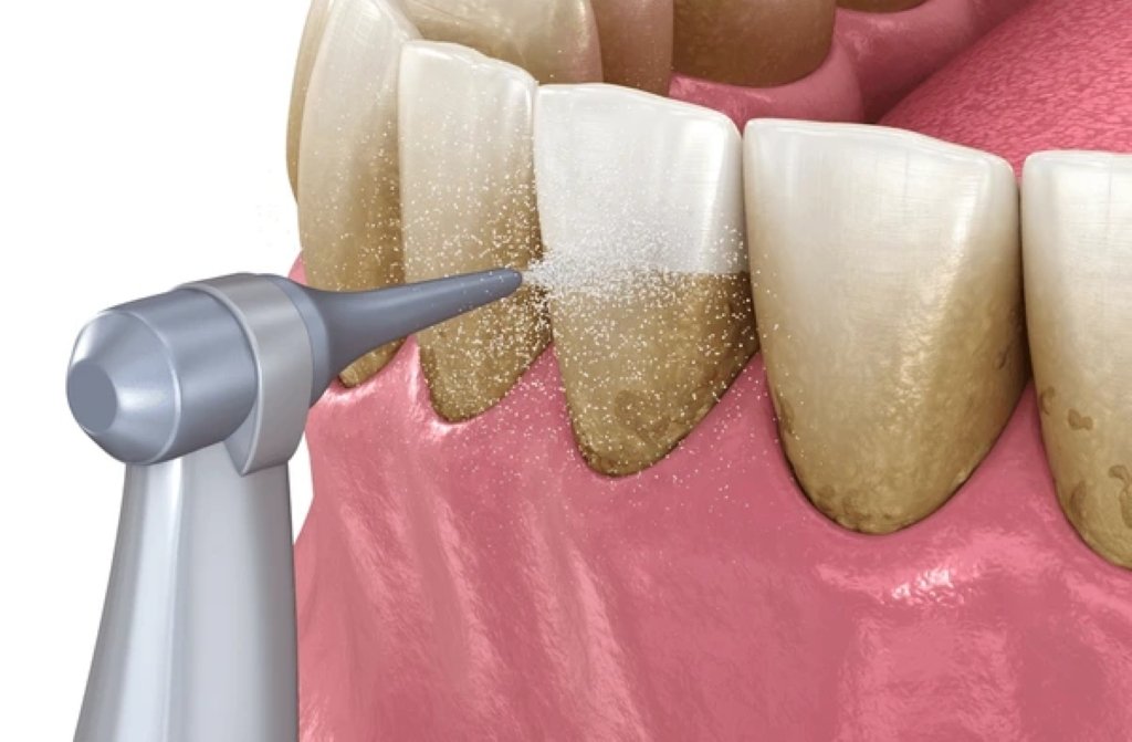 periodontal treatment in wetaskiwin ab