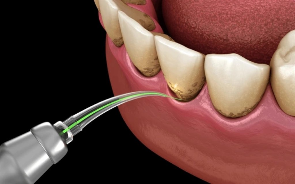 periodontal treatment near you