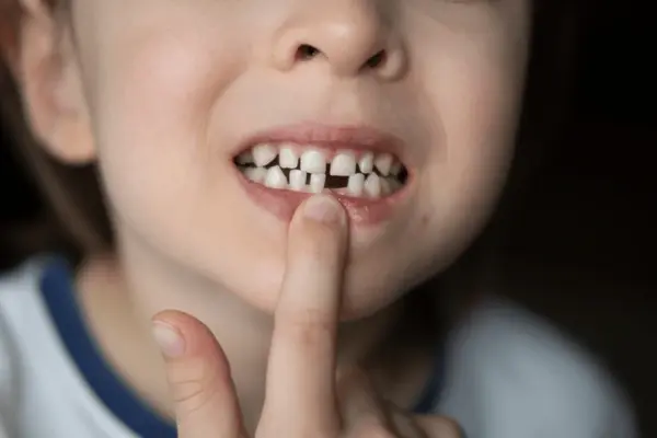close up of a smiling child showing their baby teeth