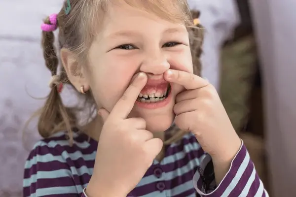 close up of a smiling child showing their growing teeth