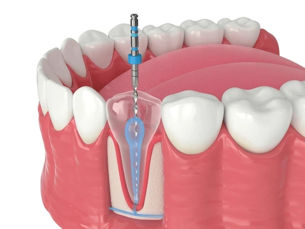 endodontics near you