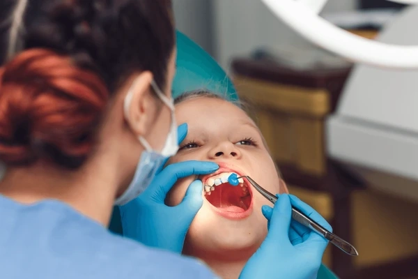 fluoride treatment near you
