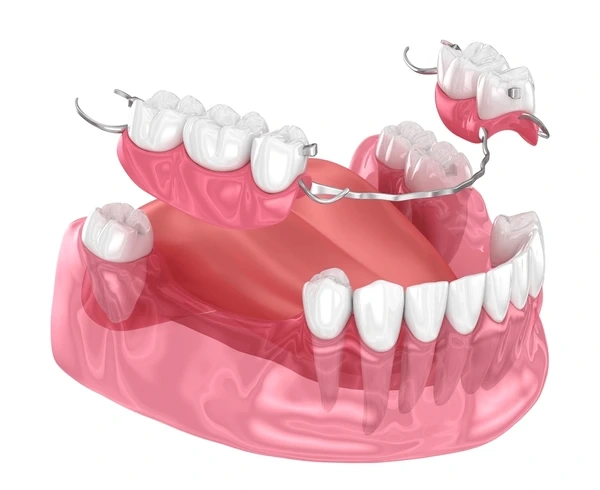 partial dentures near you