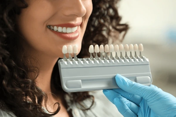 porcelain veneers in minneapolis mn