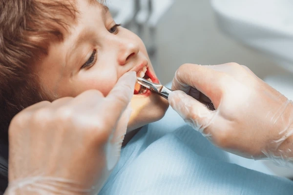 simple tooth extractions near you
