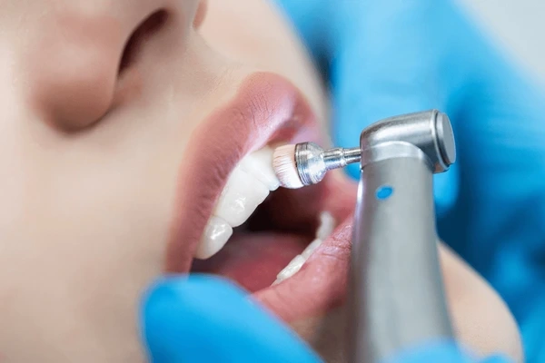 teeth cleanings near you