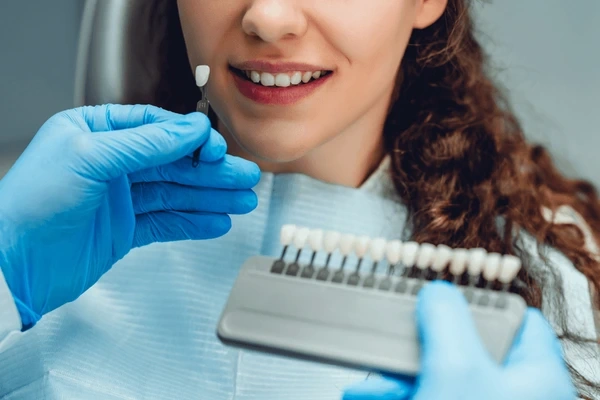 tooth colored fillings near you
