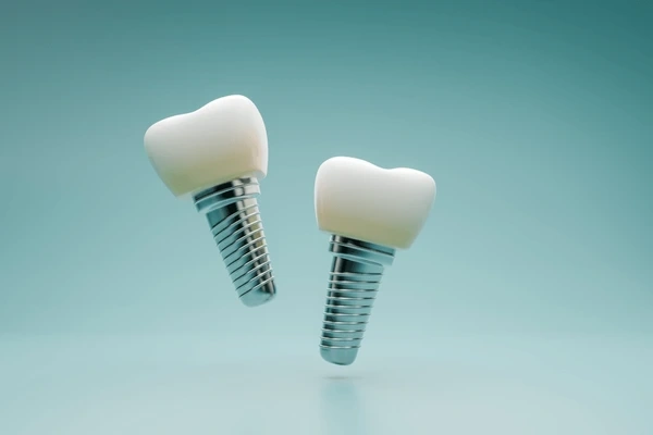 dental implants in downtown toronto on