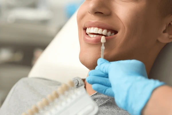 dental veneers in downtown toronto on