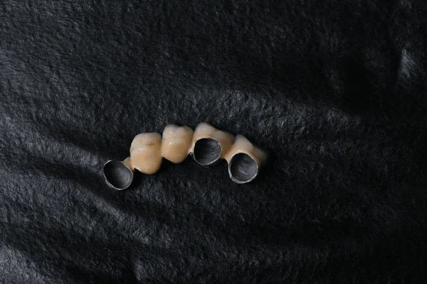 same day crowns near you