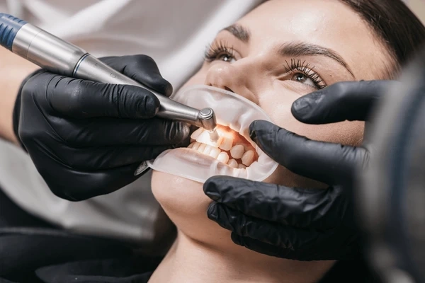 teeth cleaning near you
