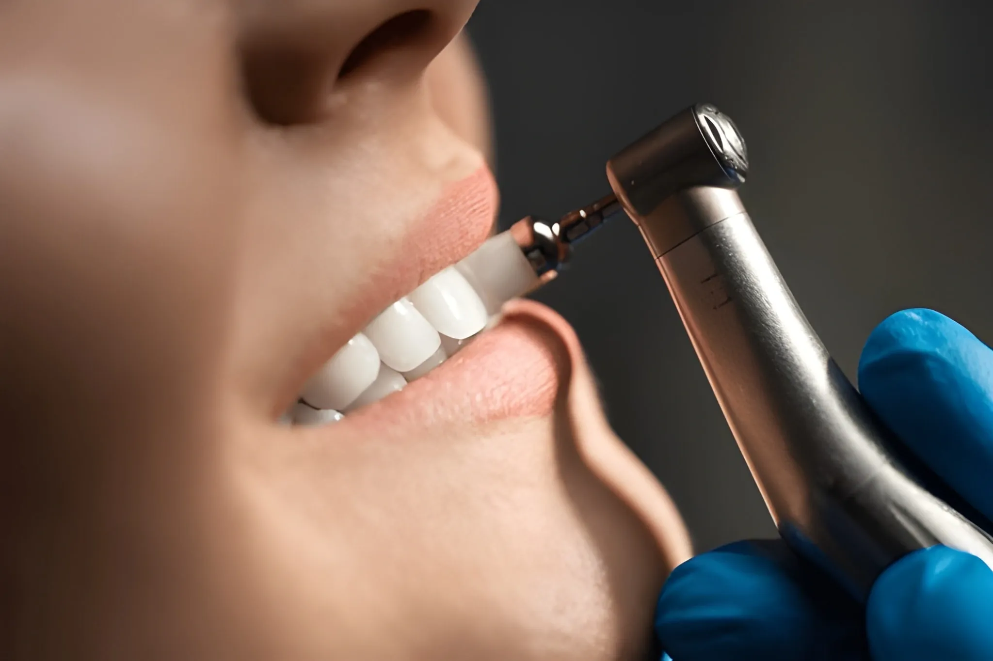 teeth whitening near you